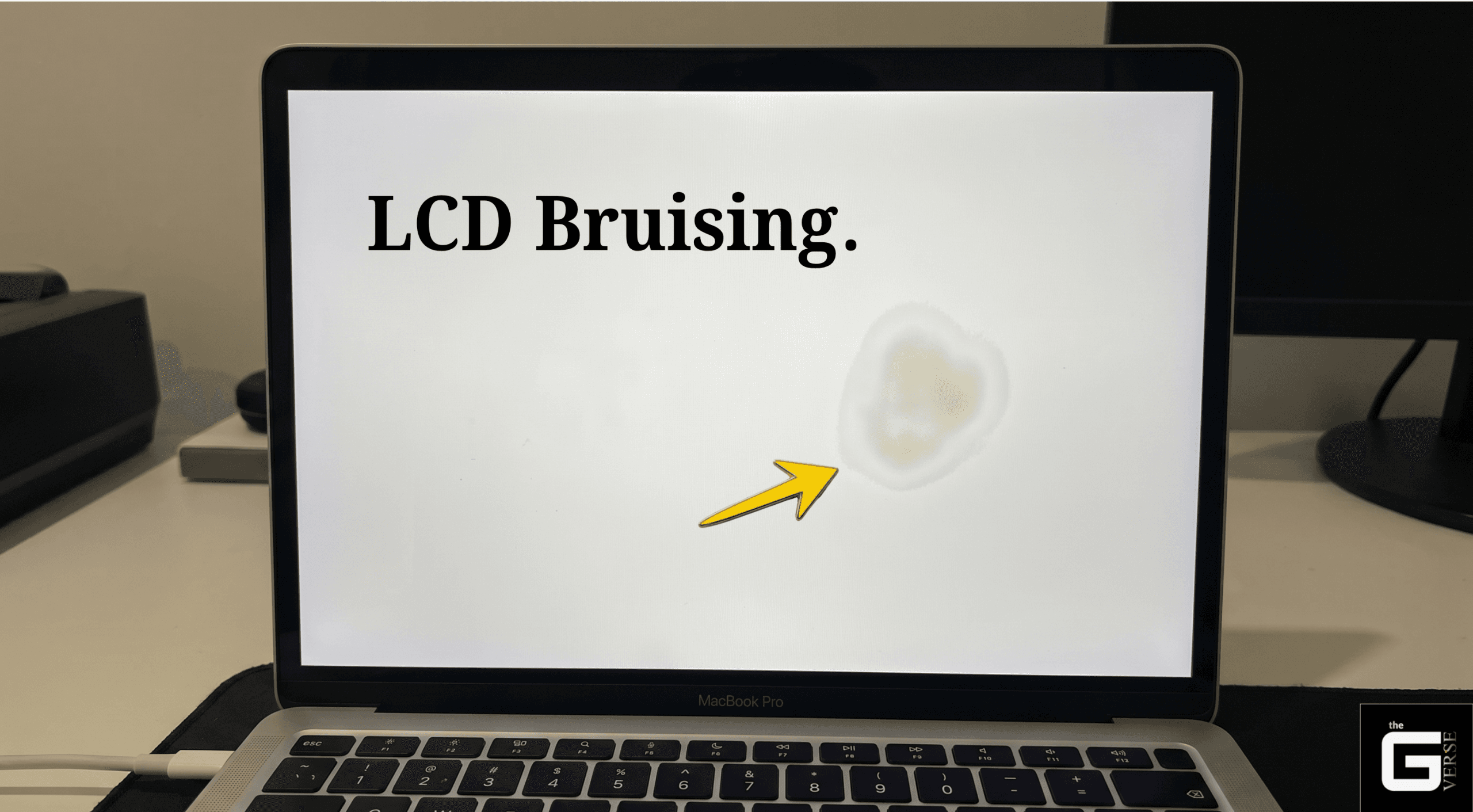 what is lcd bruising